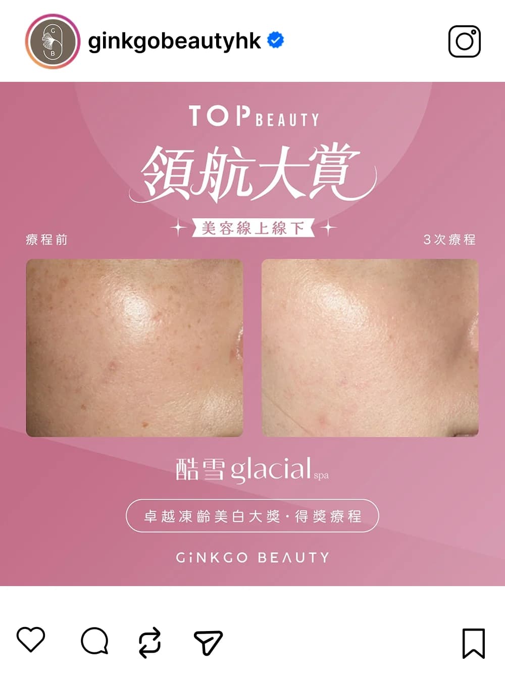 TopBeauty Awards 2024 社交媒體貼文 22